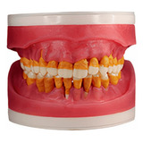 Refil De Cirurgia Com Dentes De Periodontia Ac025   Pronew