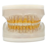 Refil De Periodontia Ac104
