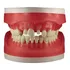 Refil Manequim De Materiais Dentarios Ac100   Pronew