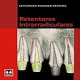 Retentores Intrarradiculares