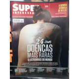 Mundo