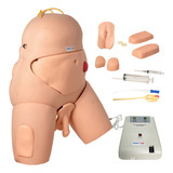 Colostomia