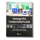 Tomografia Computadorizada Brinde
