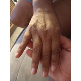 Unhas De Gel