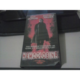 Vhs Hemoglobina