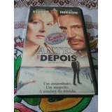 Vhs Antes E Depois